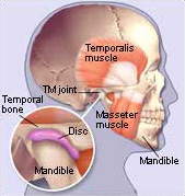 TMJ Disorders